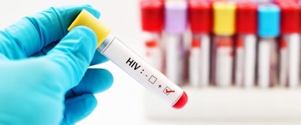 تسجيل 21 إصابة بالإيدز في الاردن خلال 2020