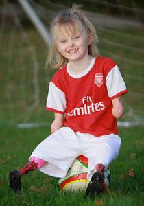 طفلة مبتورة الارجل والايدي تنضم لفريق كرة القدم بمدرستها!!  صور