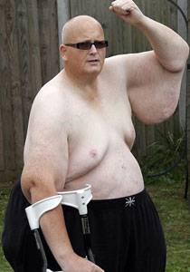 اثقل رجل بالعالم يقوم بانقاص اكثر من نصف وزنه! صور