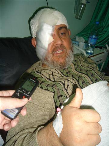 الدكتور صالح فقد عينه بمسيرة المفرق . ..