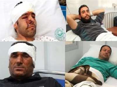 جرحى تفجيرات دمشق يروون تفاصيل لحظة الانفجار