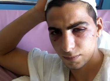 حدث يتهم الدرك بالاعتداء عليه في السلط  بالصور