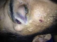 الحالة الاولى في تاريخ المملكة ....توجيه تهمة التعذيب لضابط في المخدرات و5 من زملائه