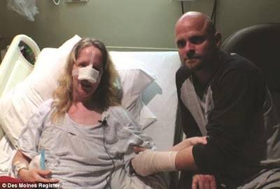 رجل يعض كلباً لينقذ زوجته