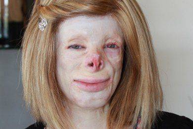 بالصور.. حياة جديدة لصاحبة أكثر الوجوه رعبا