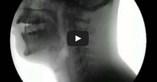 فيديو مذهل يصور الانسان أثناء أكله من خلال أشعه XRay