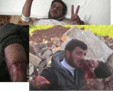 آكل لحوم البشر يسقط في اشتباكات القصير شاهد الفيديو