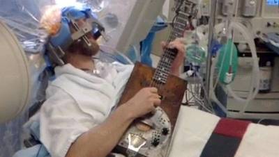 موسيقي يعزف الجيتار أثناء عملية جراحية بمخه  فيديو