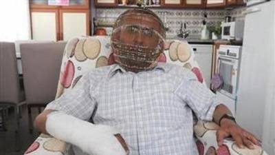 يضع رأسه داخل قفص ليقلع عن التدخين