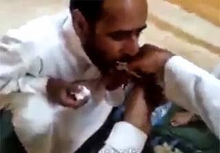 بالفيديو.. سعودي يخلع ضرس صديقه بـ «كماشة»