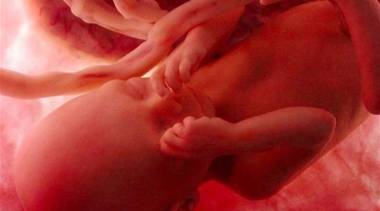 سعودية تحاول توليد نفسها بعد تجاهل ممرضات المستشفى صرخاتها المتكررة فتخنق جنينها بالحبل السري