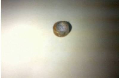 بالصور  بطارية ساعة بأنف طفلة تفضح مستشفى الاسراء.. ووزير الصحة يتوعد بتحقيق موسع!!