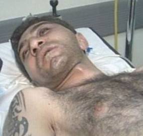 مريض بسرطان الرئتين يتبرع بقضيبه الذكري لربيع الاحمد