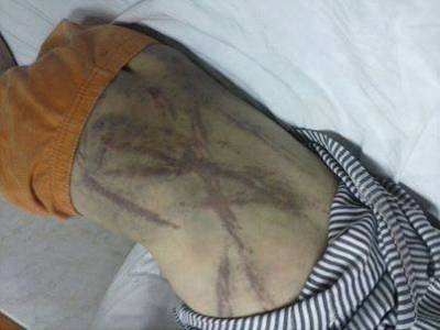 شاهد صورة مؤلمة جدا لطفلة جعلتها زوجة أبيها شبيهة الحمار الوحشي!