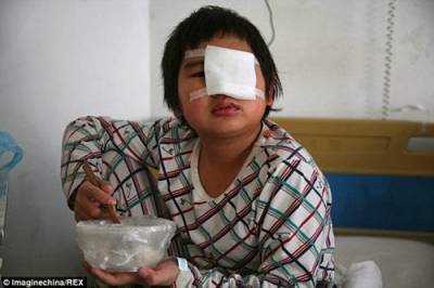 معلم طلب من كل التلاميذ في الصف صفع زميلهم على وجهه لتقصيره في اداء الواجب