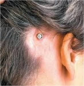 أبو حسان: لا علم للنقابة عن أطباء زرعوا سماعات للغش