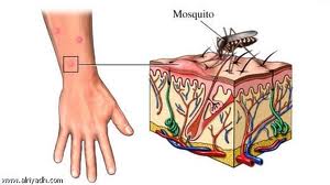 مصابون بالحمى المالطية يشكون عدم توفر العلاج في المزار