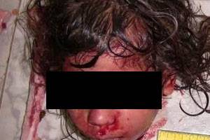 شاهد بالفيديو.. اغتصاب طفلة و رميها من الطابق العاشر ..!