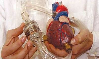 زرعوا له قلبًا صناعيًا فمات.. رحيل صاحب أول قلب صناعي