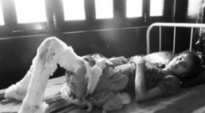 رجل يحرق أعضاء زوجته التناسلية و هي حامل لرفضها إعطائه المهر