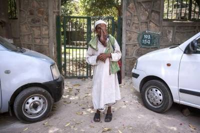 الرجل المنصهر يرفض إعانة لإصلاح تشوهات خطيرة بوجهه ليتسول  صور