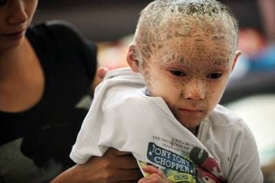 بالصور والفيديو .. الطفل السمكة