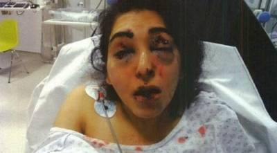 هندي شك بزوجته قام خلع عيونها