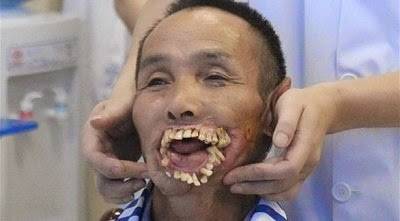 عضة ذئب تحول صينياً إلى مسخ بشري منذ 56 عاماً