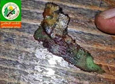 بالصورة القسام تعرض شريحة التتبع المزروعة في جسد الأسير الإسرائيلي!