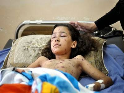 “دينا” أغمضت عينيها خوفا من الصواريخ الإسرائيلية..وتعجز عن فتحها مجددا