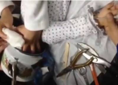 بالفيديو: لحظة تحرير رأس طفلة من داخل إبريق شاي..!