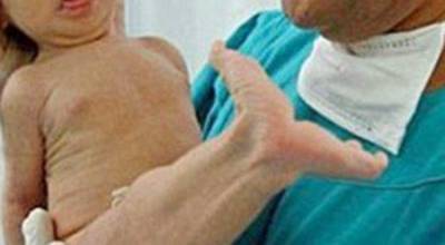 بالصور : ولادة طفلة تشبه عروسة البحر.. سبحان الله!!