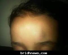 مدرسة تربية دينية تعتدي على ابنتها وتعذبها .. صورة