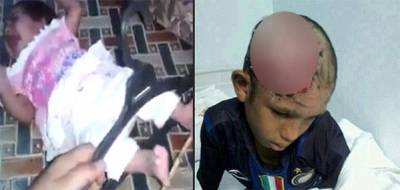 طفل مسلوخ ورضيع يُضرب وآخر يُفصل رأسه.. العنف ضد الأطفال يتفشى