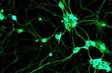 باحثة مصرية: أوقفت نمو الخلايا السرطانية للثدي