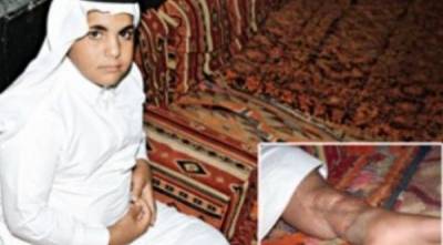 إصابة طفل سعودي بالإيدز بعد تعرضه لحادث مروري .