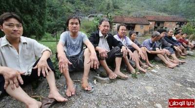 بالصور: مرض غامض يحول سكان قرية بأكملها إلى كائنات غريبة