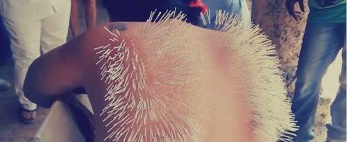 بالفيديو .. فتاة إسبانية تغرز 2500 إبرة في ظهرها احتجاجاً على إقامة مصارعة الثيران