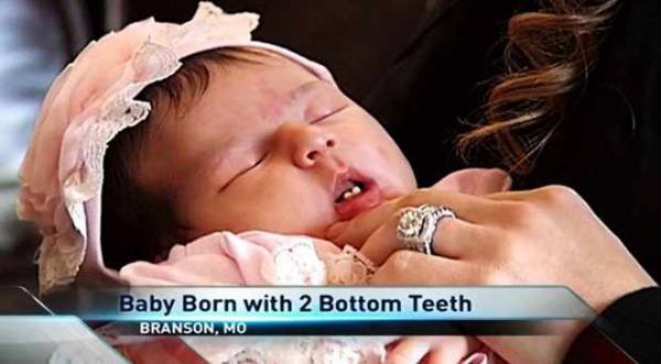 أغرب رضيعة في العالم تولد بأسنان