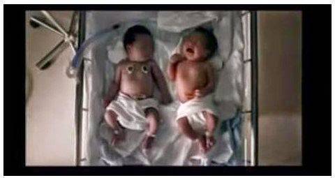 امرأة تنجب توأم واحد حى و الآخر ظنوه ميتا.. شاهد المفاجئة