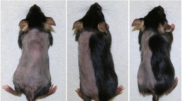 دواء يحل مشكلة الصلع ويُعيد الشعر في 21 يوماً