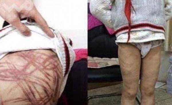 أم تُشهوه جسد ابنها بالتبني لعدم إنهاء واجب المدرسة