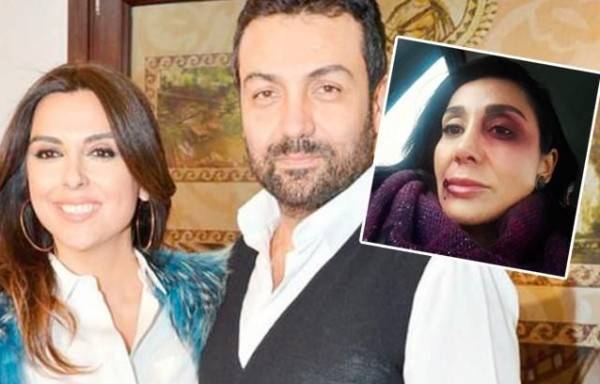 النجم التركي الشهير بـ الأسمر معرض للسجن بسبب ضربه حبيبته