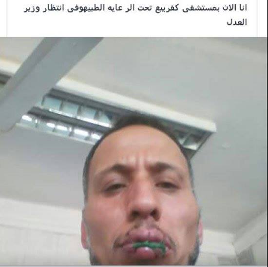 مصري يقوم بخياطة فمه اعتراضاً على اضطهاده من مرشح برلماني