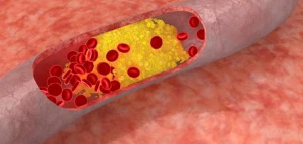 ما الذي يخفض الكوليسترول في الدم