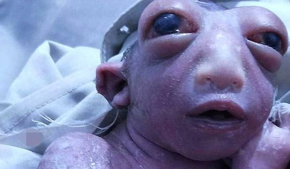 شاهد: مولودة بملامح كائنات فضائية تدفع أهالي قرية للاحتشاد لرؤيتها