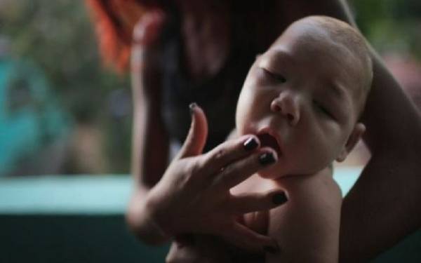 بعد أن ضرب 17 دولة وارعب الملايين . ماهو فيروس زيكا الخطير؟