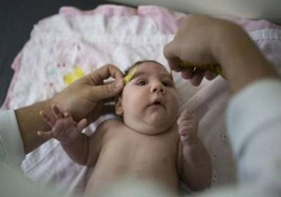 وزارة الصحة البرازيلية: زيادة حالات صغر حجم الرأس لدى المواليد ليس سببها أحد المبيدات الحشرية