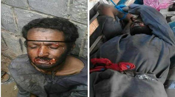 في اليمن.. القبض على مصاص دماء بالجرم المشهود!