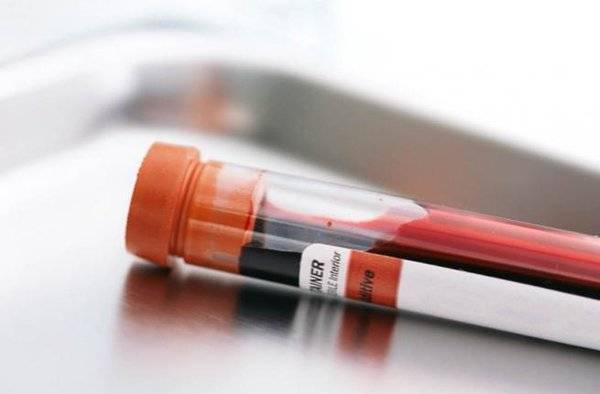 5 أمراض تسبب نزول الدم مع البول تعرف عليها